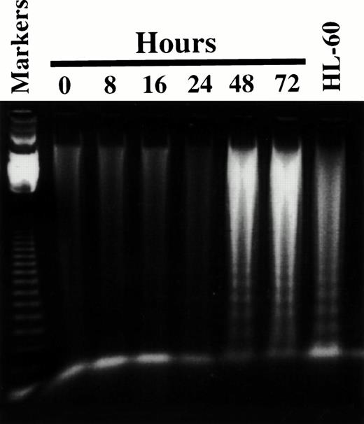 Fig. 6. 8Cl-AD induces chromatin ladder formation. Five million MM.1S cells are treated for the indicated times with 3 μmol/L 8Cl-AD and low molecular weight DNA is obtained as described in Materials and Methods. Markers are the 123-bp DNA ladder (GIBCO BRL). DNA is fractionated through 1% agarose. HL-60 cells treated with 0.15 μmol/L camptothecin serve as a positive control for the DNA isolation protocol.