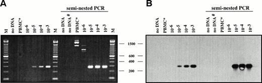 Fig. 1. Estimation of PCR and Southern blot sensitivity for detection of L428 cells admixed with normal PBMCs. (A and B) DNAs isolated from serial dilutions of L428 cells in normal PBMCs were amplified using VH5FRI and L428rev1 (296 bp)/rev2 primers (287 bp). PCR products were separated on a 2% agarose gel and stained with ethidium bromide (A) and subjected to Southern blot hybridization using an internal FITC-labeled oligonucleotide (L428intern) and visualized by ECL (B). M, 100-bp DNA ladder. Negative controls: DNA from a healthy volunteer (PBMC*), water control after first and second (#) PCR.