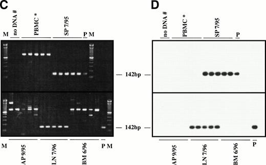 Fig. 4. Representative seminested PCR analysis of H-RS cell-specific DNA in apheresis material, bone marrow, spleen, and lymph node samples from a patient with NS-HD (patient no. 1; A and B) and a patient with MC-HD (patient no. 2; C and D). DNA samples (1 μg) were amplified in five replicates (except control PBMCs for patient no. 1) using NSfor and NSrev1/rev2 primers (patient no. 1) and MCfor and MCrev1/rev2 primers (patient no. 2). PCR products were fractionated by agarose gel electrophoresis (2%) and stained with ethidium bromide (A and C). After Southern blot, the DNA was hybridized to the internal FITC-labeled oligonucleotide NSintern (B) or MCintern (D) and visualized by ECL. M, 100-bp DNA ladder; P, PCR product amplified from single H-RS cells served as the positive controls (NSVH1, 249 bp; MCVH1, 142 bp). Negative controls: DNA from a healthy volunteer (PBMC*), water control after first and second (#) PCR.