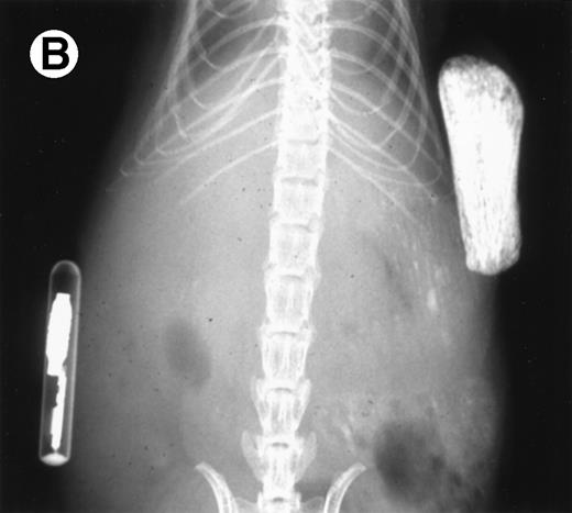 Fig. 7. Loss in density of human bone in myeloma-bearing SCID-hu mouse as seen by x-radiography. Human bones are visible in the right-hand side. The highly contrasted devices visible in the bottom left corner are implant transponders used to identify the mice. (A) Myeloma-bearing mouse (patient no. 6): (B) Age-matched control SCID-hu mouse.