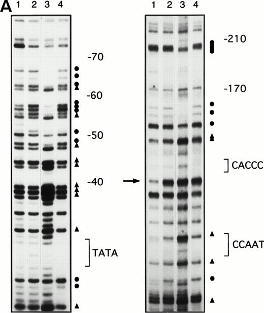 Fig. 3. In vivo footprinting analyses of the γ-globin gene promoter. (A) A sickle cell anemia patient (patient no. 8). Lane 1, hemin-induced K562; lane 2, before therapy; lane 3, during therapy; lane 4, naked DNA. (B) A β-thalassemia patient (patient no. 7). Lane 1, before therapy; lane 2, during therapy; lane 3, naked DNA. The location of the canonical elements is shown at the right of figures. (•) Footprinted G residues; (▴) G residues that showed hyperreactivity to DMS. The arrow indicates the location of three G residues that were footprinted in K562 cells but were not footprinted in patients’ samples.