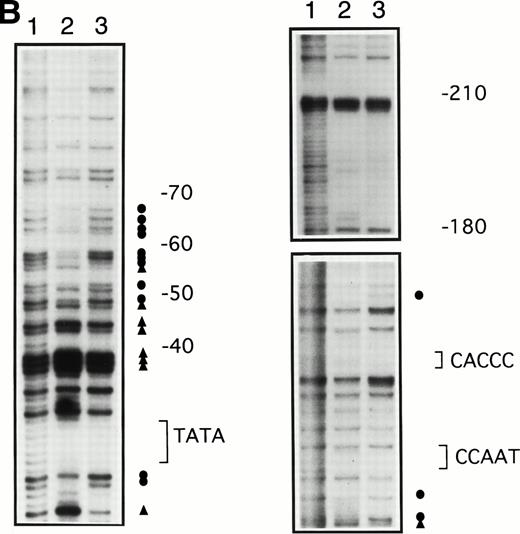 Fig. 3. In vivo footprinting analyses of the γ-globin gene promoter. (A) A sickle cell anemia patient (patient no. 8). Lane 1, hemin-induced K562; lane 2, before therapy; lane 3, during therapy; lane 4, naked DNA. (B) A β-thalassemia patient (patient no. 7). Lane 1, before therapy; lane 2, during therapy; lane 3, naked DNA. The location of the canonical elements is shown at the right of figures. (•) Footprinted G residues; (▴) G residues that showed hyperreactivity to DMS. The arrow indicates the location of three G residues that were footprinted in K562 cells but were not footprinted in patients’ samples.