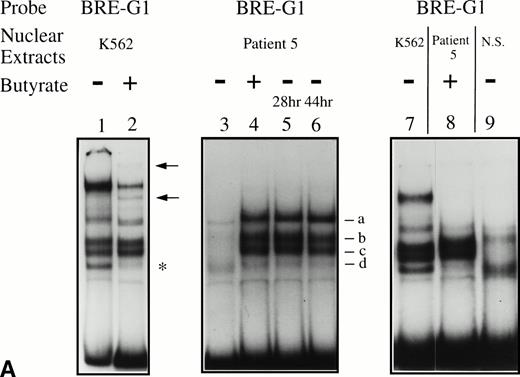 Fig. 5. EMSAs using the BRE-G1 sequence of the γ-globin gene promoter or TFIID as probe. (A) Nuclear extracts from uninduced K562 or a patient’s erythroblasts (patient no. 5) without treatment are shown by the −; butyrate-induced K562 cells or patient’s erythroblasts on treatment (patient no. 5) are designated by the +. Nuclear extracts prepared from erythroblasts of a normal subject are designated NS. Lane designations are as follows: lane 1, K562 (untreated); lane 2, K562 (butyrate-treated); lane 3, patient no. 5 (before treatment); lane 4, patient no. 5 (on butyrate treatment); lane 5, patient no. 5 (28 hours after treatment); lane 6, patient no. 5 (44 hours after treatment); lane 7, K562 (untreated); lane 8, patient no. 5 (on treatment); lane 9, normal subject (N.S.). Four major protein-DNA complexes, designated a through d, were detected. Arrows denote protein-DNA complexes that appeared in K562 extracts during butyrate treatment. The asterisk denotes a band that is diminished with exposure to butyrate. Nuclear extracts from patient no. 5 are shown before (−), during (+), and 28 and 44 hours after therapy (−28hr and −44hr) are shown. Three new shifted bands are demonstrated during butyrate therapy and persist for at least 44 hours, at which time globin protein synthesis is still altered with an increase in γ-globin and decrease in β-globin compared with baseline. (B) EMSA using a TFIID probe. The origins of nuclear extracts and addition of butyrate are shown on the top of figure. Lane designations are as follows: lane 1, patient no. 5 (before treatment); lane 2, patient no. 5 (on treatment); lane 3, patient no. 5 (28 hours after treatment); lane 4, patient no. 5 (44 hours after treatment); lane 5, K562 (untreated); lane 6, patient no. 5 (on treatment); lane 7, normal subject (N.S.). The arrow indicates the major protein-DNA complex observed with the probe. No new or shifted complexes are observed with butyrate treatment. (C) The wild-type γ-globin promoter probe (W) and a mutant probe (M) were used in EMSA. Probes and the cellular origin of nuclear extracts are shown above the lanes. The positions of the four major protein-DNA complexes, a through d, are shown on the right of figure. A decrease in binding of bands b and c was observed with the BRE-G1 sequence in which mutations were introduced, compared with binding of the normal sequence. (D) Competition assays with an CP2 sequence oligonucleotide. Assays were performed in the absence (lanes 1 and 3) or presence (lanes 2 and 4) of 100-fold molar excess of a cold competitor. Probes and the cellular origin of the nuclear extracts assayed are shown above the lanes. Binding of the top band was abolished in the presence of excess cold CP2.