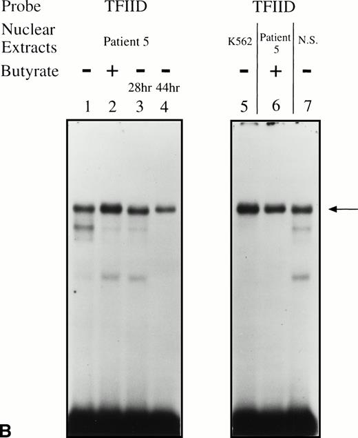 Fig. 5. EMSAs using the BRE-G1 sequence of the γ-globin gene promoter or TFIID as probe. (A) Nuclear extracts from uninduced K562 or a patient’s erythroblasts (patient no. 5) without treatment are shown by the −; butyrate-induced K562 cells or patient’s erythroblasts on treatment (patient no. 5) are designated by the +. Nuclear extracts prepared from erythroblasts of a normal subject are designated NS. Lane designations are as follows: lane 1, K562 (untreated); lane 2, K562 (butyrate-treated); lane 3, patient no. 5 (before treatment); lane 4, patient no. 5 (on butyrate treatment); lane 5, patient no. 5 (28 hours after treatment); lane 6, patient no. 5 (44 hours after treatment); lane 7, K562 (untreated); lane 8, patient no. 5 (on treatment); lane 9, normal subject (N.S.). Four major protein-DNA complexes, designated a through d, were detected. Arrows denote protein-DNA complexes that appeared in K562 extracts during butyrate treatment. The asterisk denotes a band that is diminished with exposure to butyrate. Nuclear extracts from patient no. 5 are shown before (−), during (+), and 28 and 44 hours after therapy (−28hr and −44hr) are shown. Three new shifted bands are demonstrated during butyrate therapy and persist for at least 44 hours, at which time globin protein synthesis is still altered with an increase in γ-globin and decrease in β-globin compared with baseline. (B) EMSA using a TFIID probe. The origins of nuclear extracts and addition of butyrate are shown on the top of figure. Lane designations are as follows: lane 1, patient no. 5 (before treatment); lane 2, patient no. 5 (on treatment); lane 3, patient no. 5 (28 hours after treatment); lane 4, patient no. 5 (44 hours after treatment); lane 5, K562 (untreated); lane 6, patient no. 5 (on treatment); lane 7, normal subject (N.S.). The arrow indicates the major protein-DNA complex observed with the probe. No new or shifted complexes are observed with butyrate treatment. (C) The wild-type γ-globin promoter probe (W) and a mutant probe (M) were used in EMSA. Probes and the cellular origin of nuclear extracts are shown above the lanes. The positions of the four major protein-DNA complexes, a through d, are shown on the right of figure. A decrease in binding of bands b and c was observed with the BRE-G1 sequence in which mutations were introduced, compared with binding of the normal sequence. (D) Competition assays with an CP2 sequence oligonucleotide. Assays were performed in the absence (lanes 1 and 3) or presence (lanes 2 and 4) of 100-fold molar excess of a cold competitor. Probes and the cellular origin of the nuclear extracts assayed are shown above the lanes. Binding of the top band was abolished in the presence of excess cold CP2.