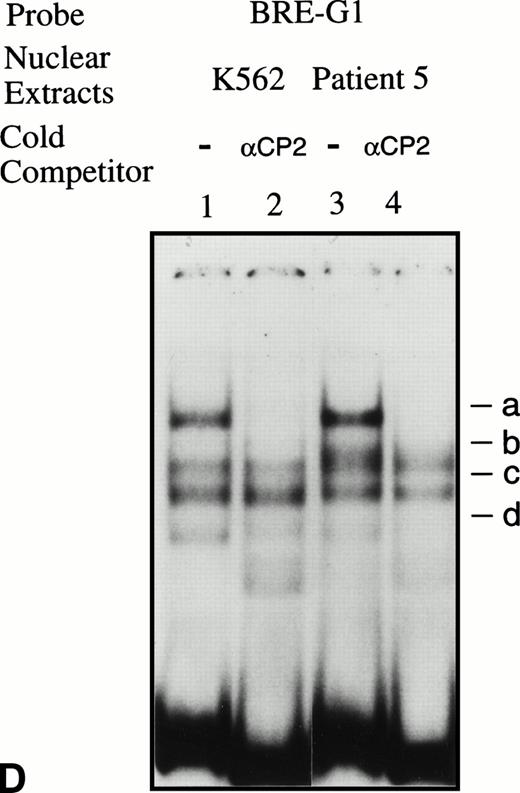 Fig. 5. EMSAs using the BRE-G1 sequence of the γ-globin gene promoter or TFIID as probe. (A) Nuclear extracts from uninduced K562 or a patient’s erythroblasts (patient no. 5) without treatment are shown by the −; butyrate-induced K562 cells or patient’s erythroblasts on treatment (patient no. 5) are designated by the +. Nuclear extracts prepared from erythroblasts of a normal subject are designated NS. Lane designations are as follows: lane 1, K562 (untreated); lane 2, K562 (butyrate-treated); lane 3, patient no. 5 (before treatment); lane 4, patient no. 5 (on butyrate treatment); lane 5, patient no. 5 (28 hours after treatment); lane 6, patient no. 5 (44 hours after treatment); lane 7, K562 (untreated); lane 8, patient no. 5 (on treatment); lane 9, normal subject (N.S.). Four major protein-DNA complexes, designated a through d, were detected. Arrows denote protein-DNA complexes that appeared in K562 extracts during butyrate treatment. The asterisk denotes a band that is diminished with exposure to butyrate. Nuclear extracts from patient no. 5 are shown before (−), during (+), and 28 and 44 hours after therapy (−28hr and −44hr) are shown. Three new shifted bands are demonstrated during butyrate therapy and persist for at least 44 hours, at which time globin protein synthesis is still altered with an increase in γ-globin and decrease in β-globin compared with baseline. (B) EMSA using a TFIID probe. The origins of nuclear extracts and addition of butyrate are shown on the top of figure. Lane designations are as follows: lane 1, patient no. 5 (before treatment); lane 2, patient no. 5 (on treatment); lane 3, patient no. 5 (28 hours after treatment); lane 4, patient no. 5 (44 hours after treatment); lane 5, K562 (untreated); lane 6, patient no. 5 (on treatment); lane 7, normal subject (N.S.). The arrow indicates the major protein-DNA complex observed with the probe. No new or shifted complexes are observed with butyrate treatment. (C) The wild-type γ-globin promoter probe (W) and a mutant probe (M) were used in EMSA. Probes and the cellular origin of nuclear extracts are shown above the lanes. The positions of the four major protein-DNA complexes, a through d, are shown on the right of figure. A decrease in binding of bands b and c was observed with the BRE-G1 sequence in which mutations were introduced, compared with binding of the normal sequence. (D) Competition assays with an CP2 sequence oligonucleotide. Assays were performed in the absence (lanes 1 and 3) or presence (lanes 2 and 4) of 100-fold molar excess of a cold competitor. Probes and the cellular origin of the nuclear extracts assayed are shown above the lanes. Binding of the top band was abolished in the presence of excess cold CP2.