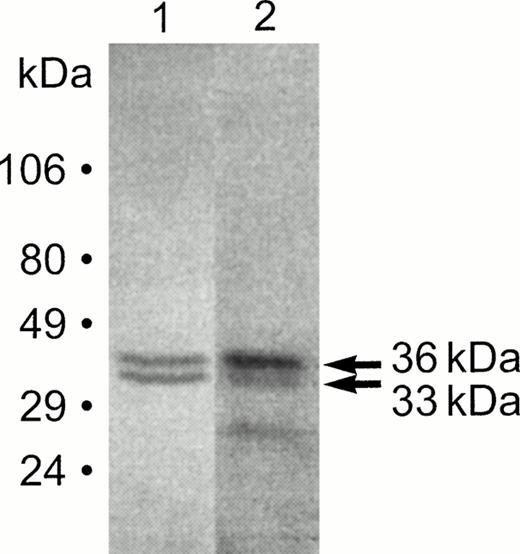 Fig. 1. Detection of Emp isoforms in macrophage membranes. Macrophage membrane proteins were separated by 18% SDS-PAGE and transferred to a nitrocellulose (NC) membrane. The NC membrane was probed with anti-Emp antibodies (lane 1) and immunoreactive bands were detected with an enhanced chemiluminescence system, or the NC membrane was incubated with radioiodinated erythroblasts (lane 2) and processed for autoradiography. Molecular weight standards are shown on the left.