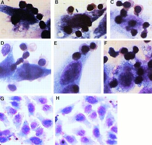 Fig. 6. Attachment of erythroblasts to transfected and nontransfected HeLa cells. Early erythroblasts were cultured with HeLa cells transfected with the full-length (Emp-1) plasmid (A through F), with the truncated (Emp-2) plasmid (H), or with nontransfected HeLa cells (G) for 3 to 4 days. On day 3 or 4, floating cells were removed and the adherent cells were washed two times to remove any trapped nonadherent cells. Cells adhering on the petri dishes were fixed and stained with Wright-Giemsa without detaching from the dishes and examined by bright-field microscopy. Original magnification: (A through F) × 100; (G and H) × 40.