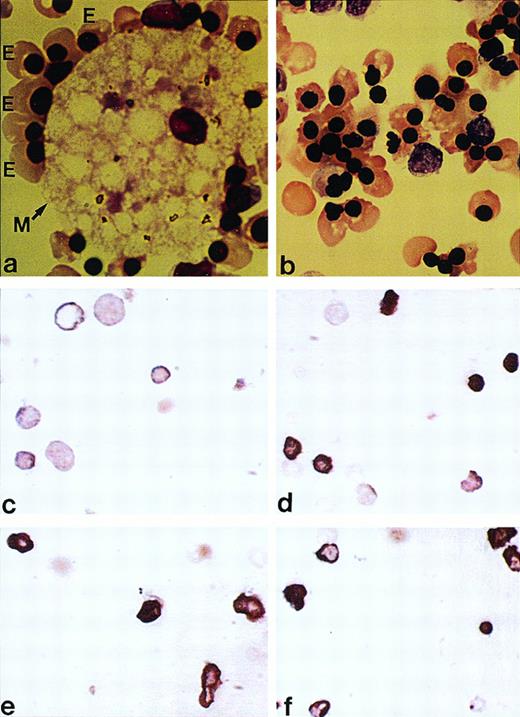 Fig. 7. In situ analysis for DNA fragmentation. (Top panel) Wright-Giemsa–stained cytocentrifuged preparations of cells obtained on day 12 of the second phase of (a) macrophage-containing and (b) macrophage-depleted cultures. An erythroblastic island consisting of a central macrophage (M) surrounded by a ring of late erythroblasts (E) is shown in (a). (Middle and bottom panels) Erythroblasts harvested on day 12 of the second phase of each culture were examined by the TUNEL method, (c) macrophage-containing culture, (d) macrophage-depleted culture, (e) macrophage-containing culture in the presence of anti-Emp peptide (p1) antibodies, and (f) macrophage-depleted culture supplemented with macrophage conditioned medium. Apoptotic cells are identified by more dense staining.