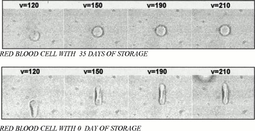 Fig. 1. Deformed red blood cells at 35-day and 0-day storage with velocities varying from 120 to 210 μm/s.
