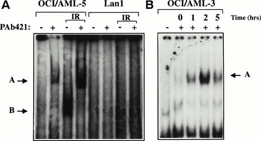 Fig. 1. DNA binding activity of p53 protein in AML cell lines. Nuclear extracts prepared from untreated or γ-irradiated OCI/AML-5 (A) and OCI/AML-3 (B) cells were incubated with a32P-labeled double-stranded oligonucleotide containing the p53 consensus sequence (p53CON) with (+) or without (−) the p53-specific monoclonal antibody PAb421 and analyzed by EMSA. Lan1 cells, which lack p53 protein, were used as a negative control. The OCI/AML-5 and Lan1 extracts were prepared 3 hours after γ-irradiation with a dose of 6 Gy. The OCI/AML-3 extracts were prepared at the times indicated after γ-irradiation with a dose of 2 Gy. The arrow labeled B points to the p53:DNA complex, and the arrow labeled A points to the supershifted antibody:p53:DNA complex.