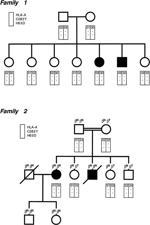 Fig. 1. Pedigree of the two families with juvenile genetic hemochromatosis. Circles denote female family members and squares denote male family members. Solid symbols indicate probands. In family 2, the parents were consanguineous (first cousins). Each rectangle indicates the HLA-A locus and the presence (+) or absence (−) of the C282Y and H63D mutations. All individuals but the probands had normal body iron status. Some individuals in family 2 were heterozygous for β-thalassemia (βNβT), whereas the remaining ones had normal β-gene (βNβN).