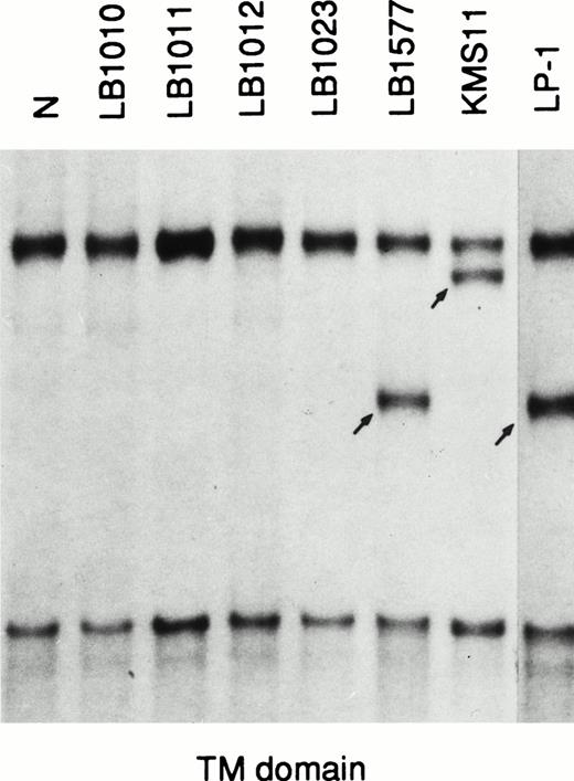 Fig. 2. PCR-SSCP analysis of the FGFR3 gene. N, normal control; migrating fragments different from the normal control are indicated by arrows.