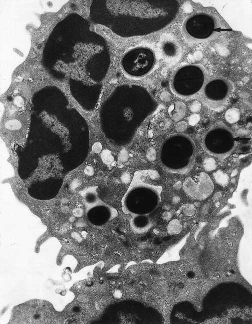 Fig. 3. Transmission electron micrograph of S aureusinside the phagosome of a human neutrophil. Arrows pointed to examples of S aureus within phagosomes (original magnification × 15,000). (Courtesy of W.A. Day, Department of Pathology, Christchurch School of Medicine.)