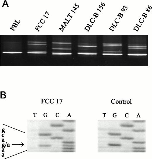 Fig. 1. Detection of Fas mutations in NHL. (A) The 5′-end of exon 9 of the Fas gene was amplified using primers 9I-F and 9I-R, and mutations were detected by DGGE analysis in follicle center cell lymphoma (FCC) 17 (E256K), MALT 145 (N248K), DLC-B 156 (N248K), DLC-B 93 (L262F), and DLC-B 86 (D244V). PBL, DNA isolated from peripheral blood lymphocytes of a normal volunteer. (B) Direct sequence analysis of heteroduplexes recovered from the gel shown in (A), revealing the G1008A transition (E256K) in FCC 17.