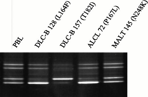 Fig. 2. Detection of allelic loss of the Fas gene in NHL by DGGE. A region encompassing the biallelic polymorphism, −670A/G, in the Fas promoter was amplified with primers FAS-734GC and FAS-623, and the two alleles were subsequently resolved by electrophoresis in a denaturing gradient gel. Unequal distribution of the two alleles was observed in DLC-B 128, anaplastic large cell lymphoma (ALCL) 72, and DLC-B 157, suggesting that oneFas allele was lost in the tumor cells. These three tumors harbor missense mutations in exon 6 or exon 7 of the Fas gene. In contrast, even distribution of the two alleles was observed in MALT 145, which harbors the N248K mutation in exon 9 of the Fasgene. PBL, DNA isolated from peripheral blood lymphocytes of a normal volunteer who is heterozygous for the −670A/G polymorphism.