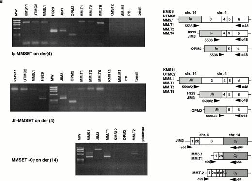 Fig. 3. The t(4;14) translocation results in IgH-MMSET hybrid transcripts. (A) The top diagram shows the genomic organization of the IgH locus on 14q32 in an IgG isotype switched plasma cell. The structural elements include the recombined VDJ exons, 5′ and 3′ enhancers (Eμ and 3′E), the noncoding Ιμ (gray rectangle) and coding Cγ (white rectangle) exons, and the switch regions (circles). The transcription may initiate either from promoters (black arrowhead) upstream of JH or Iμ, in both cases with splicing to the Cγ exon. The second diagram shows the 4p16 locus, with FGFR3 on the telomeric side, and MMSET on the centromeric side. The MMSET exons are depicted as black rectangles. The main promoter upstream of exon 1 and a cryptic promoter upstream of exon 4 are depicted. The alternative splicing occurring between exon 10-11 or exon 10-12 is shown. The lower two diagrams represent the der(4) and der(14) as result of the t(4;14) translocation in JIM3 MM cell line. On der(4), the transcription may initiate at a lower level either from (VD)J or Iμ, and in both cases it splices to exon 4 of MMSET, proceeds up to exon 10 and then it splices to exon 12, but not exon 11. However, the transcription preferentially initiates from the upregulated MMSET promoter upstream of exon 4 and generates both types of alternatively spliced forms of MMSET. On the der(14), the reciprocal hybrid transcript is formed when the transcription starts from the MMSET promoter upstream of exon 1, and it splices to the Cγ exon. (B) An RT-PCR assay detects hybrid transcripts Iμ-MMSET (top panel) and JH-MMSET (middle panel) on der(4), and MMSET-Cγ (bottom panel) on der(14) in myeloma cell lines and primary tumor samples with t(4;14) translocation. The IgH exons are shaded in gray, and the MMSET exons are depicted as white rectangles. The exon structure of each hybrid transcripts is depicted and has been obtained by sequencing of the PCR product (Iμ-MMSET and MMSET-Cγ), or deduced by the size of the PCR products, consistent with the breakpoint position (JH-MMSET).