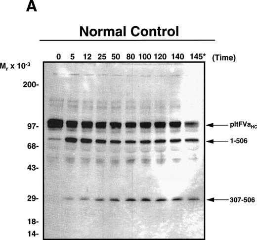 Fig. 2. APC-catalyzed inactivation of platelet-derived factor Va and factor VaLeiden bound to phospholipid vesicles. Platelets (1 × 109/mL) were treated with 5 NIH U/mL (50 nmol/L) of -thrombin for 5 minutes to both activate the platelets and release and activate the platelet-derived factor V. Hirudin (60 nmol/L) was then added to inhibit thrombin. The activated platelets were immediately removed from suspension by gentle centrifugation (1,100g, 5 minutes), and PCPS vesicles (20 μmol/L) were added to the supernatant to provide an appropriate alternate anticoagulant surface. APC (0.25 nmol/L) was then added. At selected time points, samples of the reaction mixture were withdrawn and subjected to SDS-PAGE using a 5% to 15% gradient gel. After transfer to nitrocellulose, fragments were visualized using a monoclonal antibody, HFVaHC#17, as described.25 Each of the panels represents the inactivation of secretable platelet-derived factor Va on phospholipid vesicles by APC: (A) normal platelet-derived factor Va, (B) platelet-derived factor Va derived from a heterozygous factor VLeiden individual, (C) platelet-derived factor Va derived from JMW, and (D) platelet-derived factor Va derived from FW. The time course of inactivation by APC is given at the top of each immunoblot. In (A) and (C), 145* indicates the platelet factor Va/APC mixture after a 145-minute incubation, with an additional 20 nmol/L APC incubated for 5 minutes. In (B) and (D), following a 45-minute incubation with 0.25 nmol/L APC, platelet-derived factor Va was incubated with increasing concentrations of APC (2, 10, 20, 40 nmol/L) for an additional 15 minutes, which is indicated in the last four lanes of these immunoblots. The position of the molecular weight markers are indicated at the left of the immunoblots. Arrows to the right of the immunoblots represent residue numbers corresponding to factor Va fragments derived from APC-induced cleavage.