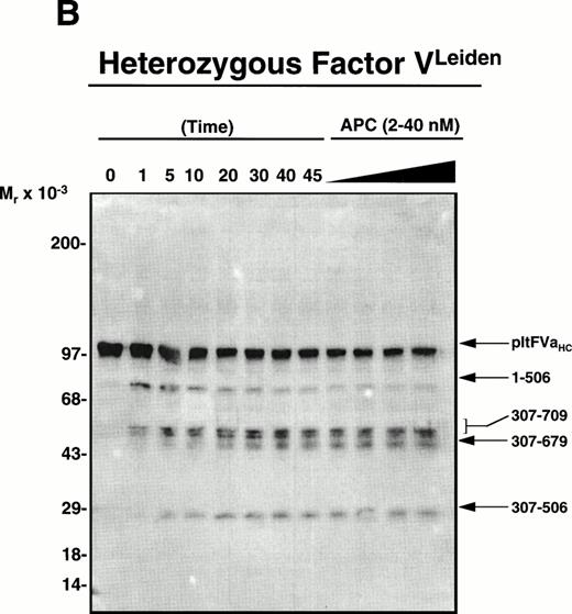 Fig. 2. APC-catalyzed inactivation of platelet-derived factor Va and factor VaLeiden bound to phospholipid vesicles. Platelets (1 × 109/mL) were treated with 5 NIH U/mL (50 nmol/L) of -thrombin for 5 minutes to both activate the platelets and release and activate the platelet-derived factor V. Hirudin (60 nmol/L) was then added to inhibit thrombin. The activated platelets were immediately removed from suspension by gentle centrifugation (1,100g, 5 minutes), and PCPS vesicles (20 μmol/L) were added to the supernatant to provide an appropriate alternate anticoagulant surface. APC (0.25 nmol/L) was then added. At selected time points, samples of the reaction mixture were withdrawn and subjected to SDS-PAGE using a 5% to 15% gradient gel. After transfer to nitrocellulose, fragments were visualized using a monoclonal antibody, HFVaHC#17, as described.25 Each of the panels represents the inactivation of secretable platelet-derived factor Va on phospholipid vesicles by APC: (A) normal platelet-derived factor Va, (B) platelet-derived factor Va derived from a heterozygous factor VLeiden individual, (C) platelet-derived factor Va derived from JMW, and (D) platelet-derived factor Va derived from FW. The time course of inactivation by APC is given at the top of each immunoblot. In (A) and (C), 145* indicates the platelet factor Va/APC mixture after a 145-minute incubation, with an additional 20 nmol/L APC incubated for 5 minutes. In (B) and (D), following a 45-minute incubation with 0.25 nmol/L APC, platelet-derived factor Va was incubated with increasing concentrations of APC (2, 10, 20, 40 nmol/L) for an additional 15 minutes, which is indicated in the last four lanes of these immunoblots. The position of the molecular weight markers are indicated at the left of the immunoblots. Arrows to the right of the immunoblots represent residue numbers corresponding to factor Va fragments derived from APC-induced cleavage.