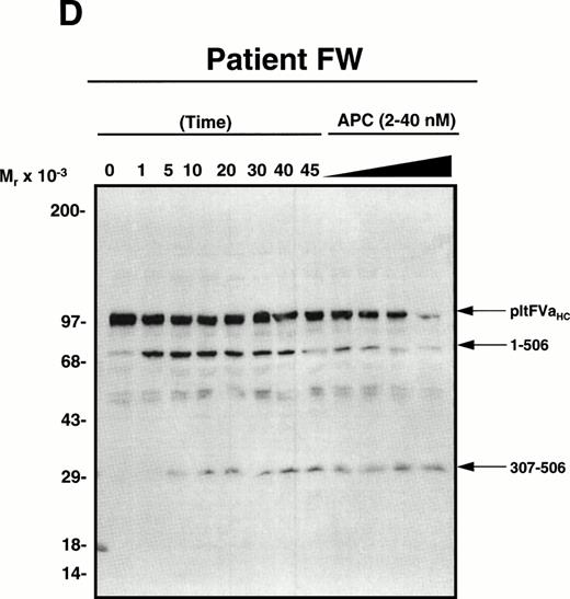 Fig. 2. APC-catalyzed inactivation of platelet-derived factor Va and factor VaLeiden bound to phospholipid vesicles. Platelets (1 × 109/mL) were treated with 5 NIH U/mL (50 nmol/L) of -thrombin for 5 minutes to both activate the platelets and release and activate the platelet-derived factor V. Hirudin (60 nmol/L) was then added to inhibit thrombin. The activated platelets were immediately removed from suspension by gentle centrifugation (1,100g, 5 minutes), and PCPS vesicles (20 μmol/L) were added to the supernatant to provide an appropriate alternate anticoagulant surface. APC (0.25 nmol/L) was then added. At selected time points, samples of the reaction mixture were withdrawn and subjected to SDS-PAGE using a 5% to 15% gradient gel. After transfer to nitrocellulose, fragments were visualized using a monoclonal antibody, HFVaHC#17, as described.25 Each of the panels represents the inactivation of secretable platelet-derived factor Va on phospholipid vesicles by APC: (A) normal platelet-derived factor Va, (B) platelet-derived factor Va derived from a heterozygous factor VLeiden individual, (C) platelet-derived factor Va derived from JMW, and (D) platelet-derived factor Va derived from FW. The time course of inactivation by APC is given at the top of each immunoblot. In (A) and (C), 145* indicates the platelet factor Va/APC mixture after a 145-minute incubation, with an additional 20 nmol/L APC incubated for 5 minutes. In (B) and (D), following a 45-minute incubation with 0.25 nmol/L APC, platelet-derived factor Va was incubated with increasing concentrations of APC (2, 10, 20, 40 nmol/L) for an additional 15 minutes, which is indicated in the last four lanes of these immunoblots. The position of the molecular weight markers are indicated at the left of the immunoblots. Arrows to the right of the immunoblots represent residue numbers corresponding to factor Va fragments derived from APC-induced cleavage.