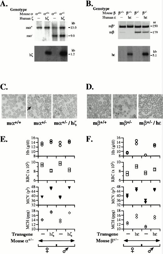Fig. 2. Function of human embryonic ζ- and -globins in adult murine erythrocytes. (A) Determination of mouse -globin genotypes by Southern analysis. Duplicate Southern transfers ofPst I–digested DNA from wild-type mice (+/+), mice carrying the hζ transgene (+/+/hζ), mice heterozygous for deletion of the m-globin genes (+/−), and mice heterozygous for deletion of the m-globin genes that carried the hζ transgene (+/−/hζ). Blots were probed with a 1.3-kb fragment originating 5′ to the deleted m-globin sequences (upper autoradiograph)23 or the h-globin promoter (lower autoradiograph).18 The sizes and identities of the wild-type (m+) and deleted m-globin loci (m−), and the hζ transgene (hζ) are indicated to the left and right of each autoradiograph, respectively. (B) Determination of mouse β-globin genotypes by combined Southern and PCR analyses. Tail DNA from mice was coamplified using paired oligomers recognizing wild-type mβ-globin genes (250-bp product) or a fragment of the HPRT cDNA comprising the knockout ‘socket’ (179-bp product).24 Reaction products were resolved and visualized on an ethidium bromide–stained 5% polyacrylamide gel. Genotypes are indicated at top. Southern analysis of the same DNA (bottom) using the 572-bp h probe indicates the presence/absence of the h transgene. The sizes and identities of the wild-type (mβ+) and deleted mβ-globin loci (mβ−), and the h transgene (h) are indicated to the left and right of each autoradiograph, respectively. (C) Thalassemic erythrocyte morphology in m+/− mice is corrected by coexpression of embryonic ζ-globin. Wright-Giemsa–stained peripheral blood smears from wild-type, m+/−, and m+/−/hζ mice, viewed under oil at 100 × magnification. A typical ‘target cell’ is indicated (arrow). (D) Thalassemic erythrocyte morphology in mβ+/− mice is corrected by coexpression of embryonic -globin. Wright-Giemsa–stained peripheral blood smears from wild-type, mβ+/−, and mβ+/−/h mice viewed under oil at 100 × magnification. (E) Resolution of anemia and normalization of erythrocyte indices in m+/− mice coexpressing embryonic ζ-globin. Erythrocyte analyses were performed on anticoagulated whole blood collected from duplicate sex-matched 13-week adult siblings. The Hb (○), RBC number (□), MCV (▾), and MCH (◊) are plotted for mice with the globin genotypes and sexes indicated at bottom. (F) Resolution of anemia and normalization of erythrocyte indices in mβ+/− mice expressing embryonic -globin. Analyses were performed on anticoagulated whole blood collected from duplicate sex-matched 9-week adult siblings as described in (E). The globin genotypes and sexes are indicated at bottom.