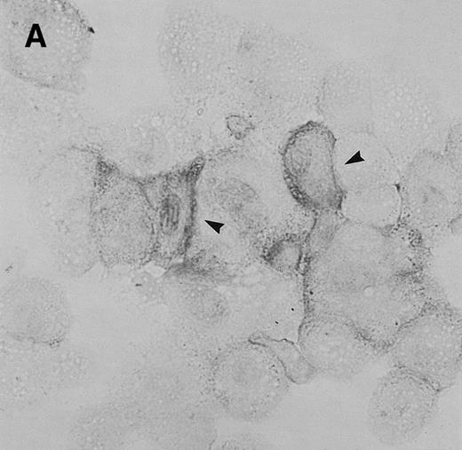 Fig. 2. Immunocytochemistry of Et-1–treated CNS-ECs. Cell preparations of treated and untreated cultures were stained with monoclonal anti-human IL-8 after 6 hours (A, treated; B, control) or 24 hours (C, treated; D, control). Arrows indicate positive cells (original magnification × 400).