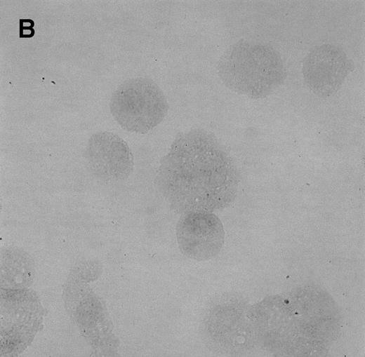 Fig. 2. Immunocytochemistry of Et-1–treated CNS-ECs. Cell preparations of treated and untreated cultures were stained with monoclonal anti-human IL-8 after 6 hours (A, treated; B, control) or 24 hours (C, treated; D, control). Arrows indicate positive cells (original magnification × 400).