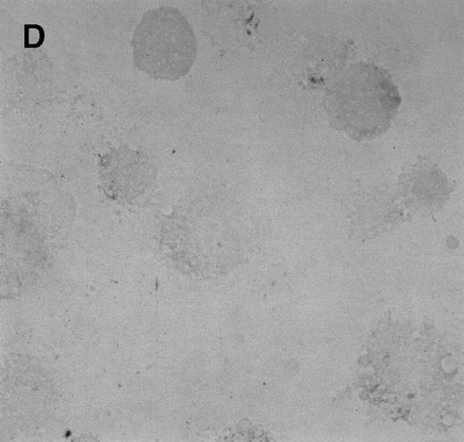 Fig. 2. Immunocytochemistry of Et-1–treated CNS-ECs. Cell preparations of treated and untreated cultures were stained with monoclonal anti-human IL-8 after 6 hours (A, treated; B, control) or 24 hours (C, treated; D, control). Arrows indicate positive cells (original magnification × 400).
