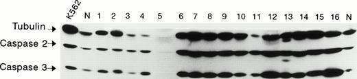 Fig. 1. Detection of caspase 2 and caspase 3 protein in AML peripheral blood low-density cells. A representative blot for cells from 16 of 185 patients is depicted. The lane loaded with protein of K562 cells is labeled “K562” and the lane loaded with protein from hematologically normal individuals’ peripheral blood cells is labeled “N.” The various protein levels of tubulin (55 kD) and of the uncleaved forms of caspase 2 (48 kD) and caspase 3 (32 kD) are depicted.