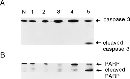 Fig. 6. Detection of caspase 3 and PARP protein in AML peripheral blood cells. Data from five of 16 AML patients are depicted. The lane loaded with protein from peripheral blood cells from normal individuals is labeled “N.” Uncleaved (32 kD) and cleaved (17 kD) caspase 3 (A) and uncleaved (116 kD) and cleaved (85 kD) PARP (B) are depicted.