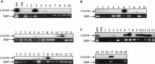 Fig. 6. Detection of proviral genome in secondary colonies derived from engrafted NOD/SCID mice. Secondary colonies were established with cells obtained from the BM of engrafted NOD/SCID animals 6 weeks after injection. The presence of LNSN proviral DNA in hematopoietic colonies derived from three mice injected with CB#1 (A), one mouse injected with CB#3 (B), and one mouse injected with CB#5 (C) was assessed by a sensitive LNGFR-specific PCR. The 425-bp–specific LNGFR product was detected by Southern blotting. Amplification of a sequence from the human mannose binding protein (MBP) gene was used to control for the presence of DNA.63