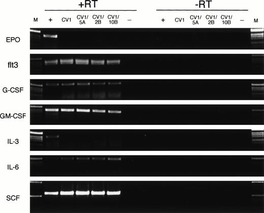 Fig. 5. Expression of cytokine genes by feeder cells. RT-PCR analysis was performed on cDNA (+RT) or mRNA (−RT) from positive control cells (+), untransduced CV-1 cells (CV1), CV-1 cells transduced with Wnt-5A, Wnt-2B, or Wnt-10B(CV1/5A, CV1/2B, or CV1/10B, respectively), and a no-template control (−). The positive control cells were human fetal brain (EPO), human FBM (flt3, IL-6, SCF), human fetal kidney (G-CSF), or KG-1 cells (GM-CSF, IL-3). DNA size ladder (M) consists of a 1-kb ladder (Life Technologies). Expected size products for the PCR amplification reactions are 410 bp (EPO), 390 bp (flt3), 547 bp (G-CSF), 396 bp (GM-CSF), 401 bp (IL-3), 495 bp (IL-6), and 590 bp (SCF).