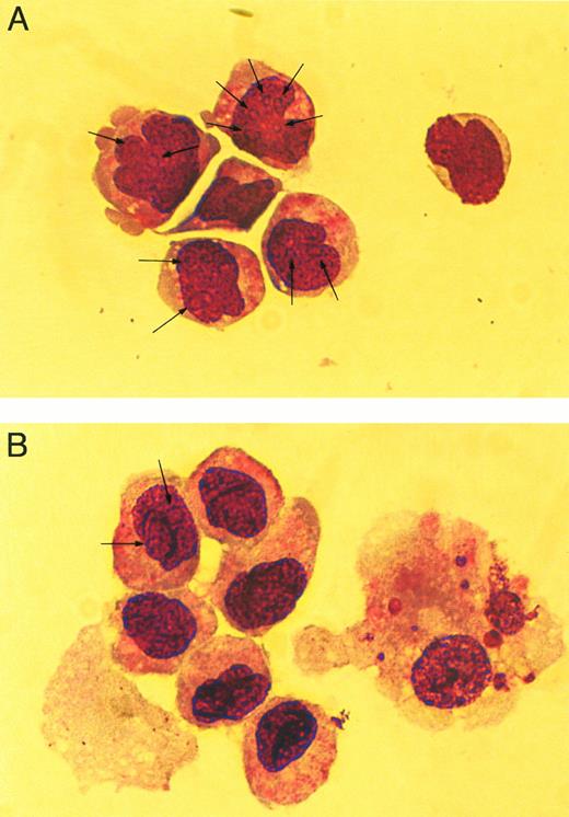 Fig. 7. Cellular morphology of cocultured cells. Wright-Giemsa–stained cytospins of hematopoietic cells cocultured withWnt-expressing feeder cells (A) and with feeder cells transduced with the MSCVneoEB vector (B). All Wnt-expressing cocultures contained similar cellular morphology (data not shown) and are represented by a single sample. Arrows indicate nucleoli within the nucleus of stained cells. Cells were photographed under phase-contrast using a 63× objective.