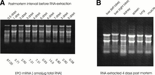 Fig. 1. (A) RNA was extracted from tissue biopsy samples obtained at the indicated time intervalls after death at routine postmortem examinations. A total of 10 μg total RNA was separated on a 1.1% agarose gel with formaldehyde and stained with ethidium bromide (0.5 μg/mL). Below the gel the values from EPO mRNA quantitation (in amol per microgram of total RNA) by competitive PCR are given. (B) RNA extracted from tissue samples of different organs taken 4 days after death was run on an agarose gel as described for (A).