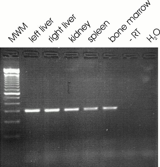Fig. 2. Representative ethidium bromide stained 3% wt/vol agarose gel showing RT-PCR signals for EPO mRNA in liver, kidney, spleen, and bone marrow tissue. MWM, Molecular weight marker (100-bp ladder); −RT, negative control for RT reaction (all RT reagents, but no RNA); H2O, negative control for PCR reaction (all PCR reagents, but no cDNA).