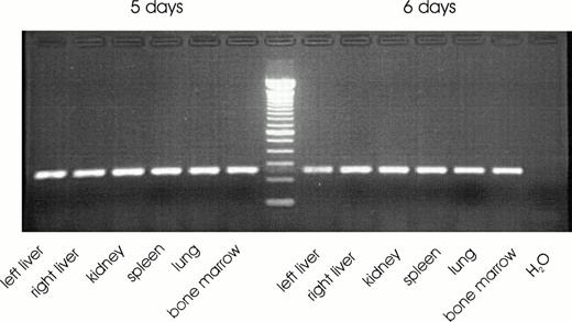 Fig. 3. DNA fragments of a qualitative PCR for GAPDH separated on an ethidium bromide stained 3% wt/vol agarose gel. Tissue samples were from routine postmortem examinations obtained at 5 or 6 days after death.
