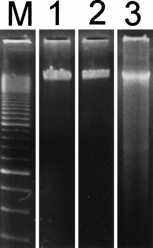 Fig. 6. Patterns of electrophoretic DNA fragmentation in accutin-treated HUVECs. HUVECs were incubated with vehicle (lane 1), GRGES (1 mmol/L, lane 2), or accutin (2 μmol/L, lane 3) for 18 hours and lysed. The total cellular DNA was isolated and subjected to electrophoretic separation by a 1.8% agarose gel. The internucleosomal DNA fragmentation was represented as the oligonucleosomal banding at lower molecular weight. A 100-bp ladder was shown in lane M. Similar results were obtained in three separate experiments.