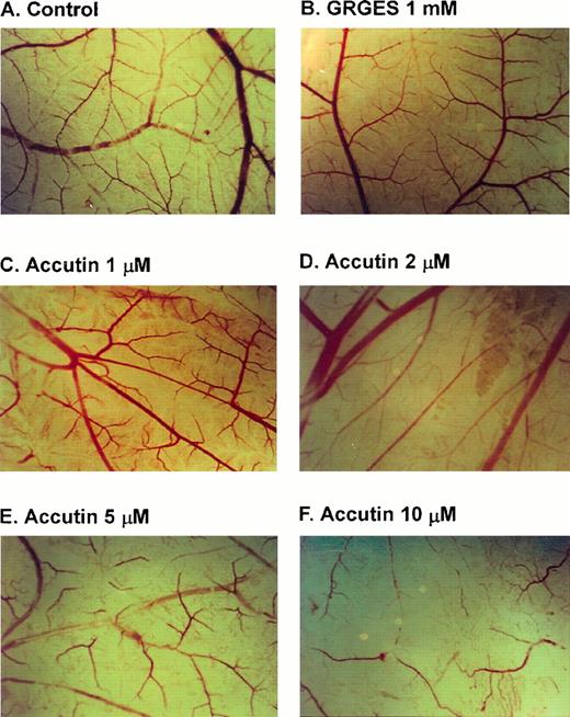 Fig. 3. Effect of accutin on spontaneous angiogenesis in vivo. CAMs of 10-day-old chick embryos were incubated with vehicle (A, control), GRGES (B, 1mmol/L), or indicated concentrations of accutin (C through F, 1, 2, 5, 10 μmol/L, all in 100 μL) for 48 hours, and then resected, fixed, and photographed with a stereomicroscope at 10× magnification.