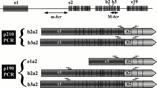 Fig. 1. Schematic representation of the types of leukemia-associated BCR-ABL transcripts that can be amplified in the two PCR protocols. Primers for first-step and second (nested)-step amplifications are indicated as arrows over the exon regions corresponding to their sequences. The upper diagram shows the BCR gene structure according to Chissoe et al29 and the major and minor breakpoint cluster regions (M-bcr and m-bcr, respectively). Because of the position of the BCR primers, the p210 PCR assay can only detect transcripts derived from breaks in M-bcr, whereas the p190 PCR assay is able to amplify fusion transcripts arising from breakpoints in either m-bcr or M-bcr (ie, from alternative splicing of the primary M-bcr derived message).