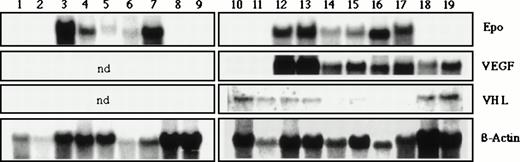 Fig. 1. Northern blot analysis of total RNA from different human brain tissues: lanes 1 and 10, normal cerebrum; 2 and 11, normal cerebellum; 3-7 and 12-17, eleven different capillary hemangioblastomas; 8, 9, 18, and 19, four different glioblastomas. The membranes were hybridized with 32P-labeled human Epo cDNA and partially reprobed with human VEGF and VHL probes. Hybridization with β-actin served as a loading control (ND, not determined).