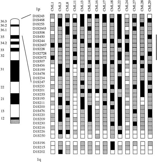 Fig. 2. Deletional map of chromosome 1 in CML. The common region of LOH was located proximal to D1S508 and distal toD1S507. Vertical bar indicates the common region of LOH. The locus symbols are shown on the left. Three loci are located on 1q (D1S196, D1S215, and D1S202). The sample name is on the top. Black box indicates LOH. White box indicates retained heterozygosity. Hatched box denotes not informative.