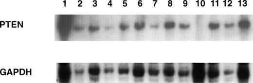 Fig. 1. Southern blot analysis of PTEN gene. High-molecular-weight DNA was digested with HindIII, and the blot was hybridized with (top panel) the JL25 probe or (bottom panel) GAPDH to estimate DNA loading. CEM (lane 10) showed homozygous deletion of the PTEN gene. Lane 1, placental DNA; lane 2, SUDHL4; lane 3, SUDHL5; lane 4, SUDHL6; lane 5, SUDHL10; lane 6, NUDHL1; lane 7, KMS5; lane 8, KMS11; lane 9, Jim3; lane 10, CEM; lane 11, HUT102; lane 12, L428; lane 13, YT.