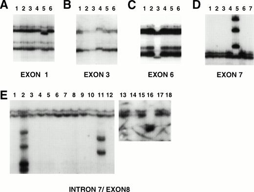 Fig. 2. Examples of PCR-SSCP analysis of PTEN exons (A, exon 1; B, exon 3; C, exon 6; D, exon 7; E, exon 8). DNA was prepared and subjected to PCR-SSCP analysis. In each analysis, lane 1 contains control DNA (placental). Alterations are present in exon 1, lane 5 (primary LBCL), exon 3, lane 4 (SUDHL10), exon 6, lane 3 (PA682PB), exon 7, lane 5 (Jurkat), and exon 8, lanes 2, 11, and 16 (primary case 1706, Jim3, and primary case 1517, respectively).