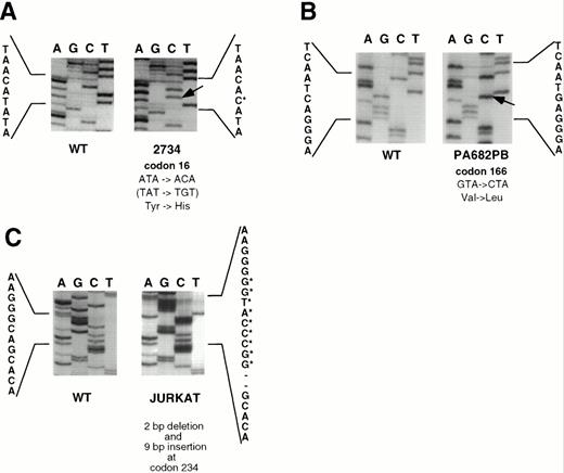 Fig. 3. Sequence analysis of SSCP-positive cell lines. (A) A → G transition in codon 16 (TAT → TGT; Tyr → His) in primary LBCL (case 2734) (reverse sequence depicted). (B) G → C transversion in codon 166 (GTA → CTA; Val → Leu) in PA682PB. (C) 2-bp deletion followed by 9-bp insertion (GGCCCATGG) at codon 234 in Jurkat cell line. Control sequences are derived from placental DNA.