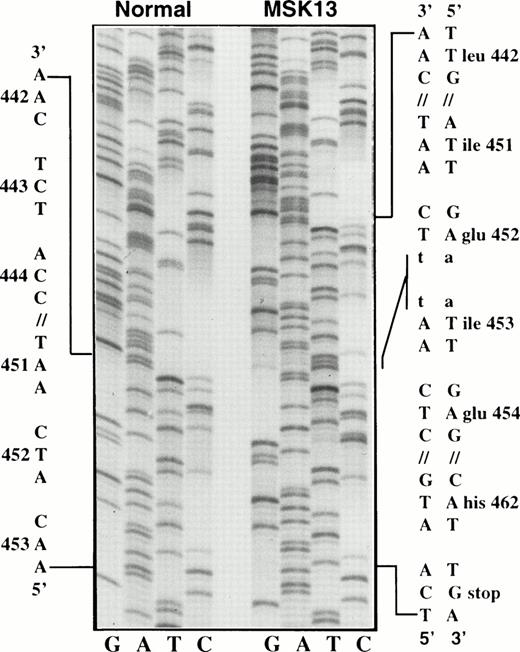 Fig. 4. Insertion duplication in exon 6 of the PIG-A gene in patient MSK13. The sequence of 32 nt starting by 5′-TCAA-3 until 5′-CAA-3 in the normal control is replicated in MSK13, but after the insertion of two thymidines. The insertion-duplication introduces a frameshift at codon 452 and leads to the production of truncated PIG-A protein of only 462 AA.