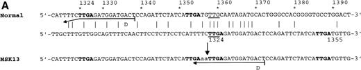 Fig. 5. High-sensitivity analysis of the 1355insAA-duplication nt 1324-1355 before and after BMT. (A) Schematic representation of the insertion-duplication in exon 6 of the PIG-A gene. At the top, two copies of the normal sequence are aligned to show direct-sequence homology (underlined) that may favor nonhomologous exchange below the sequence in the recent sample of patient MSK13. Identical bases are indicated by a vertical line. The short repeat of 4 nt flanking the duplication are boldface. The 19 mer D has been designed to match completely the mutant sequence, whereas the last 4 nt (5′-… .ttTC-3′) are mismatched to the normal sequence (see arrow bent at the left). The fragment amplified with primers -I5b and D and -I5b and f are expected to be 292 bp and 415 bp in length, respectively. (B) Gel electrophoretic analysis of nested-PCR products of exon 6 of PIG-A gene from PMN in the pretransplant sample. A fragment of 292 bp amplified with the primers -I5b and D was present in the post-transplant sample (lane 2); by contrast no amplification was obtained in the pretransplant sample (lane 1) and in a normal control sample (lane 3). When the 3 primers -I5b, D, and f were used in the same PCR reaction, a fragment of 415 bp only was amplified in the pretransplant sample and in a normal control (lanes 4 and 6), and a fragment of 292 bp only was amplified in the posttransplant sample (lane 5).