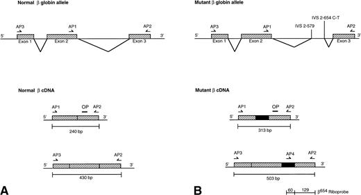 Fig. 1. Representation of the genomic and cDNA structure of the normal β allele (A) and the mutant β allele (B) showing the products obtained by RT-PCR using the primers AP1/AP2 and AP3/AP2. OP (5′-GTCTGTGTGTGCTGGCCCATCA-3′) is an oligonucleotide probe used to hybridize Southern-blotted cDNA fragments. Sequences of the primers are AP1: 5′-CTGAGGAGAAGTCTGCCGTT-3′, AP2: 5′-GCTTAGTGATACTTG TGGGCC-3′, and AP3: 5′-TGAGGAGAAGTCTCGCGTTAC-3′. A β654 riboprobe for detecting the normal and aberrantly spliced transcripts was generated by RT-PCR from a hemizygote for the β IVS 2-654 mutation, using primers AP4 (5′-CAATGTATCATGCCTCTTTGCAC-3′) and AP2.