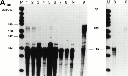 Fig. 3. (A) RNase protection assay of reticulocyte RNA, using the β654 riboprobe. Protected fragments of normal and aberrant transcripts are 129 bp and 189 bp, respectively. The lanes are represented by M: Marker (pBR322 DNA-Msp I); 1: Proband LI-1; 2: Proband LII-3; lanes 3 to 8 are the asymptomatic heterozygotes; N: normal; 9: CII-1 (β IVS 2-654 homozygote) and 10: AH (β IVS 2-654/(Aγδβ)0 thalassemia). (B) RNase protection assay of RNA extracted from erythroblasts, cultured from CD34+ peripheral progenitors, using the β654 probe. Protected fragments of the normal (βN) and aberrantly spliced (β654) transcripts, at 129 and 189 bp, are indicated. The lanes are represented by M, pBR322 DNA-Msp I; 1, RH (5 μg RNA); 2, RH (1 μg RNA); 3, normal control.