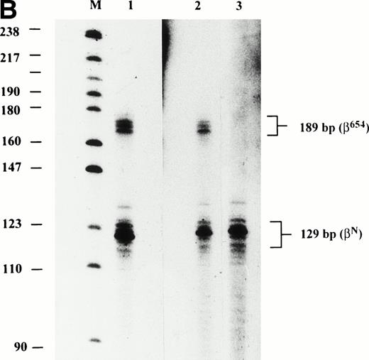 Fig. 3. (A) RNase protection assay of reticulocyte RNA, using the β654 riboprobe. Protected fragments of normal and aberrant transcripts are 129 bp and 189 bp, respectively. The lanes are represented by M: Marker (pBR322 DNA-Msp I); 1: Proband LI-1; 2: Proband LII-3; lanes 3 to 8 are the asymptomatic heterozygotes; N: normal; 9: CII-1 (β IVS 2-654 homozygote) and 10: AH (β IVS 2-654/(Aγδβ)0 thalassemia). (B) RNase protection assay of RNA extracted from erythroblasts, cultured from CD34+ peripheral progenitors, using the β654 probe. Protected fragments of the normal (βN) and aberrantly spliced (β654) transcripts, at 129 and 189 bp, are indicated. The lanes are represented by M, pBR322 DNA-Msp I; 1, RH (5 μg RNA); 2, RH (1 μg RNA); 3, normal control.