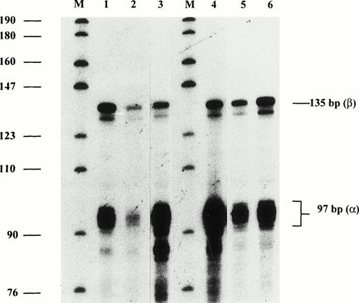 Fig. 4. RNase protection assays to assess the :β mRNA ratio in CD34+ nucleated erythroblasts and reticulocytes of heterozygotes of the β IVS 2-654 C-T mutation. RNA was extracted from the nucleated erythroblasts of one asymptomatic heterozygote (RH, lane 1) and one normal subject (lane 2). This was compared with reticulocyte RNA of RH (lane 3), the probands LI-1 (lane 4) and LII-3 (lane 5), and another asymptomatic heterozygote control (ST, lane 6). Protected fragments of  and β mRNA, at 97 and 135 bp, are indicated. M represents size marker pBR322 DNA-Msp I. The :β mRNA ratios in lanes 1 to 6 were 1.9, 2.1, 5.5, 5.4, 4.1, and 3.5, respectively. For comparison, :β mRNA ratios in controls were: 1.8 to 2.7 (normals, n = 11); 3.3 to 5.8 (β-thalassemia traits, n = 15), and 4.9, 5.1, and 6.4 (thalassemia intermedias).