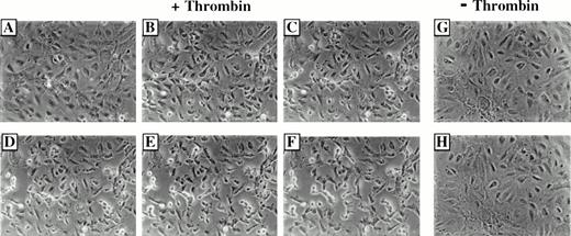 Fig. 3. Photomicrographs of HUVEC monolayers before and at intervals after treatment with HAH buffer with or without 0.1 U/mL thrombin. (A) Nearly confluent monolayer before treatment with thrombin. (B through F) The same microscope field 2 minutes (B), 5 minutes (C), 10 minutes (D), 20 minutes (E), and 40 minutes (F) after a 5-minute exposure to thrombin. (G) Nearly confluent monolayer before treatment with HAH buffer. (H) The same microscope field as in (G) 40 minutes after a 5-minute exposure to HAH alone. The monolayer treated with thrombin (B through F) demonstrates a progressive and pronounced ICGF compared with the pretreatment monolayer (A). The monolayer exposed to HAH alone demonstrated no detectable ICGF after 40 minutes (G and H). Morphometric quantification of gap formation is tabulated in Table 2.